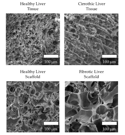 Imaging comparison of tunable scaffold stiffness for in vitro liver models
