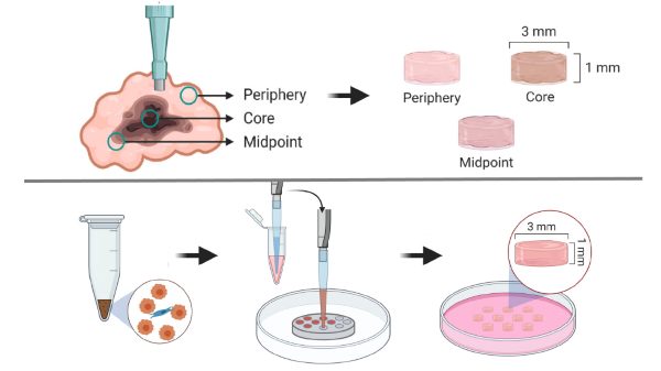 Building a co-culture prostate cancer tissue model to match in vivo xenograft tumor properties.