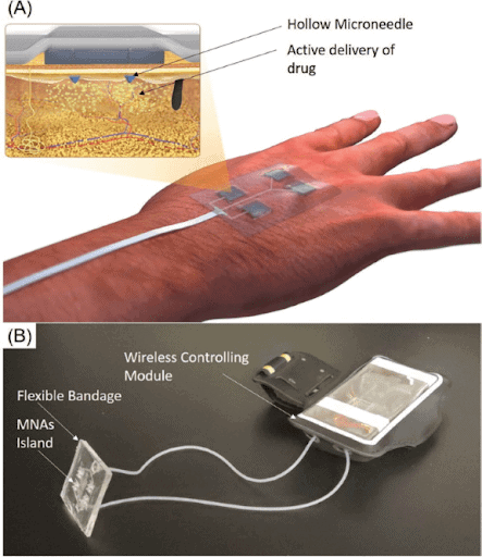 Wear Device Smart Bandage
