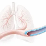 Featured image of re-endothelialization of decellularized lung scaffolds showing anti-CD31 coating and endothelial lining in a lung vessel