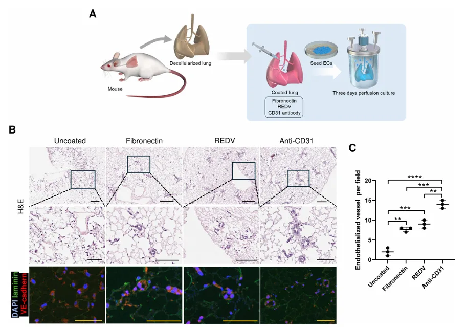 Figure showing whole-lung re-endothelialization after coating decellularized lung scaffolds with fibronectin, REDV, or anti-CD31, including histology, immunofluorescence, and quantification of endothelialized vessels.