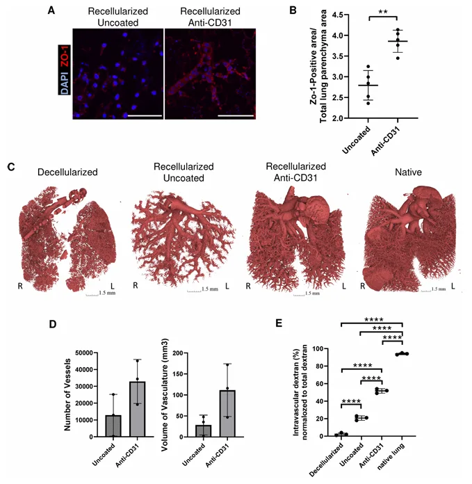 Figure showing ZO-1 staining, micro-CT vascular reconstruction, and dextran leakage analysis for anti-CD31 coated recellularized lung scaffolds.