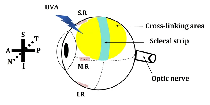Diagram showing the scleral cross-linking treatment region and location of the scleral strip used for tensile testing