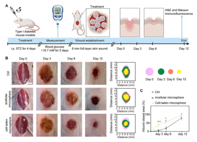 MSC hydrogel microspheres for diabetic wound healing accelerate wound closure in diabetic mice