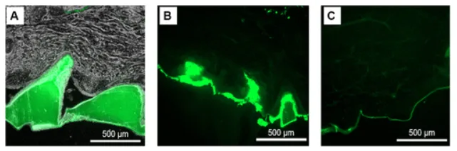 Antifreeze protein delivery into porcine skin from a silk microneedle patch shown by fluorescence imaging.